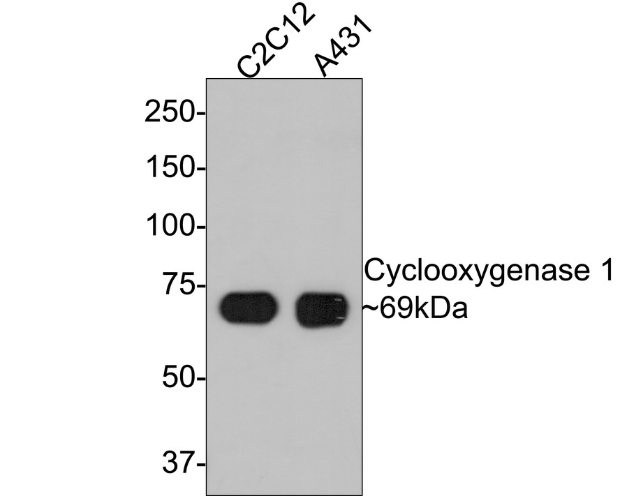 All lanes: Western blot analysis of COX1 with anti-COX1/Cyclooxygenase 1 antibody (ET1610-98) at 1/500 dilution.<br />
Lane 1: Wild-type A431 whole cell lysate (10 µg).<br />
Lane 2/3: COX1 knockdown A431 whole cell lysate (10 µg).<br />
<br />
ET1610-98 was shown to specifically react with COX1 in wild-type A431 cells. Weakened bands were observed when COX1 knockdown samples were tested. Wild-type and COX1 knockdown samples were subjected to SDS-PAGE. Proteins were transferred to a PVDF membrane and blocked with 5% NFDM in TBST for 1 hour at room temperature. The primary antibody (ET1610-98, 1/500) was used in 5% BSA at room temperature for 2 hours. Goat Anti-Rabbit IgG-HRP Secondary Antibody (HA1001) at 1:300,000 dilution was used for 1 hour at room temperature.