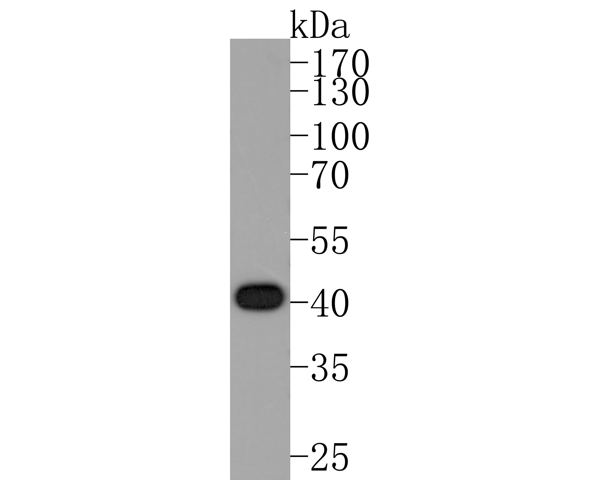 Western blot analysis of FNTB on K562 cell lysates. Proteins were transferred to a PVDF membrane and blocked with 5% BSA in PBS for 1 hour at room temperature. The primary antibody (ET1610-99, 1/500) was used in 5% BSA at room temperature for 2 hours. Goat Anti-Rabbit IgG - HRP Secondary Antibody (HA1001) at 1:200,000 dilution was used for 1 hour at room temperature.<br />
<br />
Predicted band size: 49 kDa<br />
Observed band size: 41 kDa