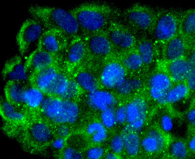 ICC staining of FNTB in JAR cells (green). Formalin fixed cells were permeabilized with 0.1% Triton X-100 in TBS for 10 minutes at room temperature and blocked with 10% negative goat serum for 15 minutes at room temperature. Cells were probed with the primary antibody (ET1610-99, 1/50) for 1 hour at room temperature, washed with PBS. Alexa Fluor®488 conjugate-Goat anti-Rabbit IgG was used as the secondary antibody at 1/1,000 dilution. The nuclear counter stain is DAPI (blue).