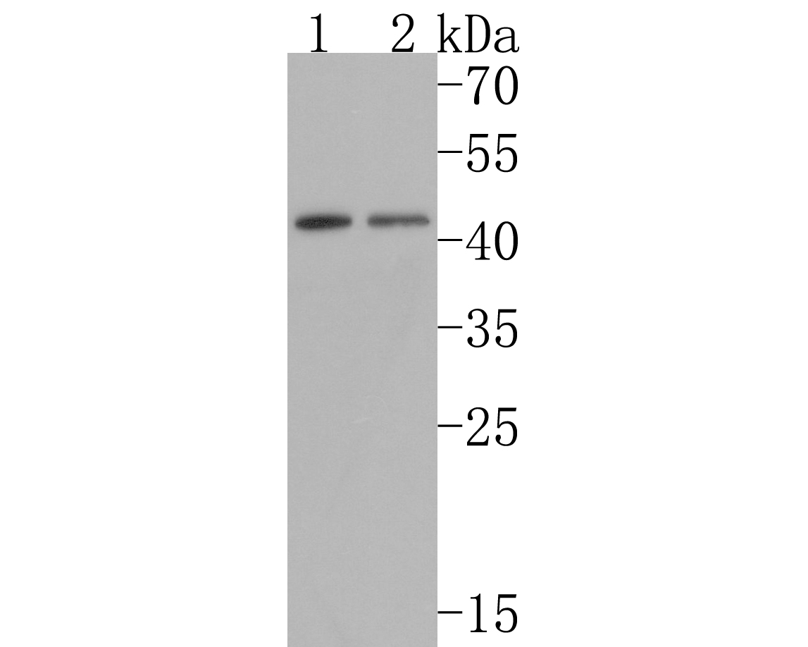 Western blot analysis of IKB beta on different lysates with Rabbit anti-IKB beta antibody (ET1611-1) at 1/500 dilution.<br />
<br />
Lane 1: Hela cell lysate<br />
Lane 2: Jurkat cell lysate<br />
<br />
Lysates/proteins at 10 µg/Lane.<br />
<br />
Predicted band size: 38 kDa<br />
Observed band size: 45 kDa<br />
<br />
Exposure time: 2 minutes;<br />
<br />
12% SDS-PAGE gel.<br />
<br />
Proteins were transferred to a PVDF membrane and blocked with 5% NFDM/TBST for 1 hour at room temperature. The primary antibody (ET1611-1) at 1/500 dilution was used in 5% NFDM/TBST at room temperature for 2 hours. Goat Anti-Rabbit IgG - HRP Secondary Antibody (HA1001) at 1:200,000 dilution was used for 1 hour at room temperature.