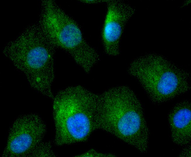 ICC staining of IKB beta in A549 cells (green). Formalin fixed cells were permeabilized with 0.1% Triton X-100 in TBS for 10 minutes at room temperature and blocked with 10% negative goat serum for 15 minutes at room temperature. Cells were probed with the primary antibody (ET1611-1, 1/50) for 1 hour at room temperature, washed with PBS. Alexa Fluor®488 conjugate-Goat anti-Rabbit IgG was used as the secondary antibody at 1/1,000 dilution. The nuclear counter stain is DAPI (blue).