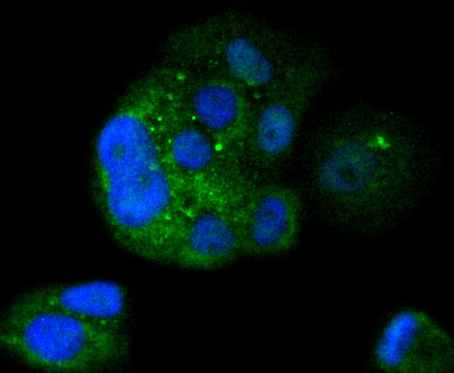 ICC staining of IKB beta in MCF-7 cells (green). Formalin fixed cells were permeabilized with 0.1% Triton X-100 in TBS for 10 minutes at room temperature and blocked with 10% negative goat serum for 15 minutes at room temperature. Cells were probed with the primary antibody (ET1611-1, 1/50) for 1 hour at room temperature, washed with PBS. Alexa Fluor®488 conjugate-Goat anti-Rabbit IgG was used as the secondary antibody at 1/1,000 dilution. The nuclear counter stain is DAPI (blue).