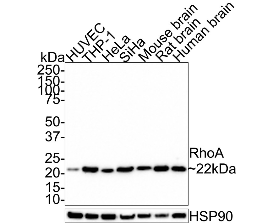 Western blot analysis of RhoA on different lysates with Rabbit anti-RhoA antibody (ET1611-10) at 1/1,000 dilution.<br />
<br />
Lane 1: HUVEC cell lysate (20 µg/Lane)<br />
Lane 2: THP-1 cell lysate (20 µg/Lane)<br />
Lane 3: HeLa cell lysate (20 µg/Lane)<br />
Lane 4: SiHa cell lysate (20 µg/Lane)<br />
Lane 5: Mouse brain tissue lysate (40 µg/Lane)<br />
Lane 6: Rat brain tissue lysate (40 µg/Lane)<br />
Lane 7: Human brain tissue lysate (40 µg/Lane)<br />
<br />
Predicted band size: 22 kDa<br />
Observed band size: 22 kDa<br />
<br />
Exposure time: 1 minute;<br />
<br />
4-20% SDS-PAGE gel.<br />
<br />
Proteins were transferred to a PVDF membrane and blocked with 5% NFDM/TBST for 1 hour at room temperature. The primary antibody (ET1611-10) at 1/1,000 dilution was used in 5% NFDM/TBST at room temperature for 2 hours. Goat Anti-Rabbit IgG - HRP Secondary Antibody (HA1001) at 1:100,000 dilution was used for 1 hour at room temperature.