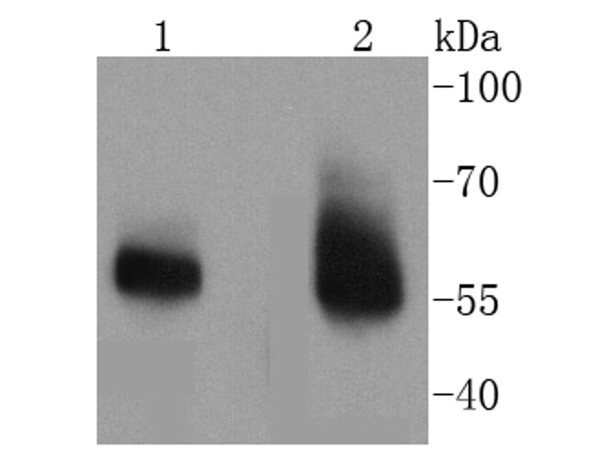 Western blot analysis of IRAKM on different lysates. Proteins were transferred to a PVDF membrane and blocked with 5% BSA in PBS for 1 hour at room temperature. The primary antibody (ET1611-11, 1/500) was used in 5% BSA at room temperature for 2 hours. Goat Anti-Rabbit IgG - HRP Secondary Antibody (HA1001) at 1:40,000 dilution was used for 1 hour at room temperature.<br />
Positive control: <br />
Lane 1: Human placenta tissue lysate<br />
Lane 2: Human thyroid tissue lysate