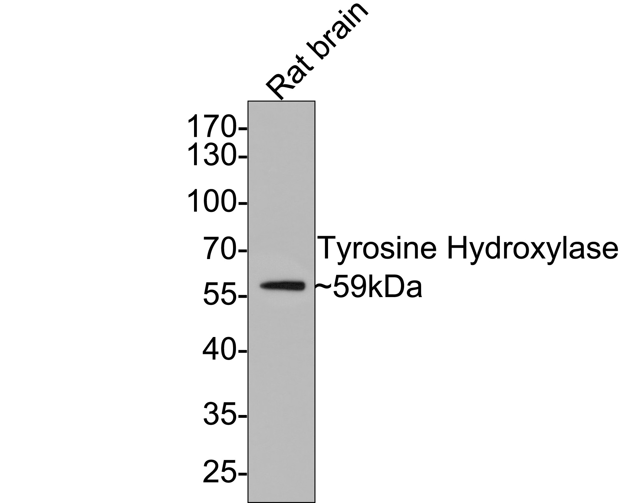 Western blot analysis of Tyrosine Hydroxylase on rat brain tissue lysates with Rabbit anti-Tyrosine Hydroxylase antibody (ET1611-12) at 1/1,000 dilution.<br />
<br />
Lysates/proteins at 20 µg/Lane.<br />
<br />
Predicted band size: 59 kDa<br />
Observed band size: 59 kDa<br />
<br />
Exposure time: 2 minutes;<br />
<br />
10% SDS-PAGE gel.<br />
<br />
Proteins were transferred to a PVDF membrane and blocked with 5% NFDM/TBST for 1 hour at room temperature. The primary antibody (ET1611-12) at 1/1,000 dilution was used in 5% NFDM/TBST at room temperature for 2 hours. Goat Anti-Rabbit IgG - HRP Secondary Antibody (HA1001) at 1:300,000 dilution was used for 1 hour at room temperature.