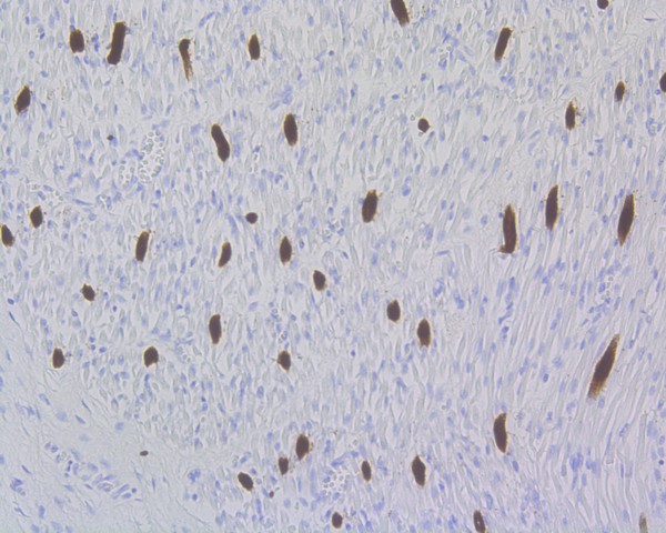 Immunohistochemical analysis of paraffin-embedded human fetal skeletal muscle tissue using anti-Myosin Light Chain 2 antibody. The section was pre-treated using heat mediated antigen retrieval with Tris-EDTA buffer (pH 8.0-8.4) for 20 minutes.The tissues were blocked in 5% BSA for 30 minutes at room temperature, washed with ddH2O and PBS, and then probed with the primary antibody (ET1611-13, 1/50) for 30 minutes at room temperature. The detection was performed using an HRP conjugated compact polymer system. DAB was used as the chromogen. Tissues were counterstained with hematoxylin and mounted with DPX.