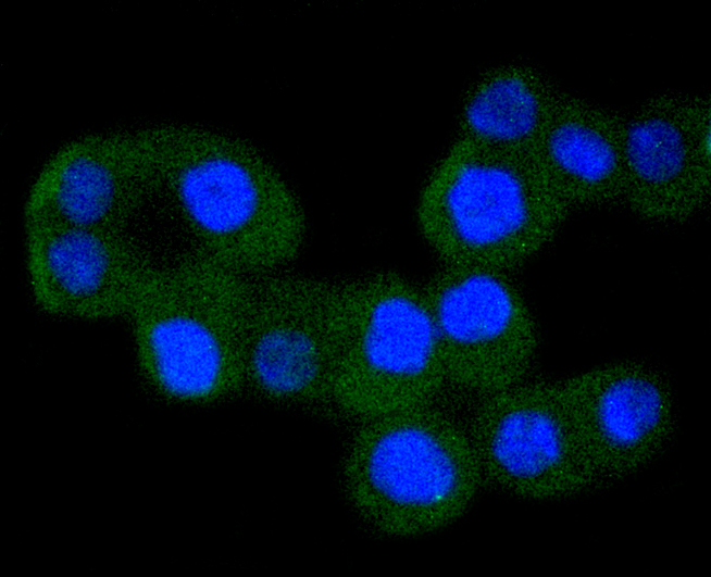 ICC staining of IKK alpha in SW480 cells (green). Formalin fixed cells were permeabilized with 0.1% Triton X-100 in TBS for 10 minutes at room temperature and blocked with 1% Blocker BSA for 15 minutes at room temperature. Cells were probed with the primary antibody (ET1611-15, 1/50) for 1 hour at room temperature, washed with PBS. Alexa Fluor®488 Goat anti-Rabbit IgG was used as the secondary antibody at 1/1,000 dilution. The nuclear counter stain is DAPI (blue).