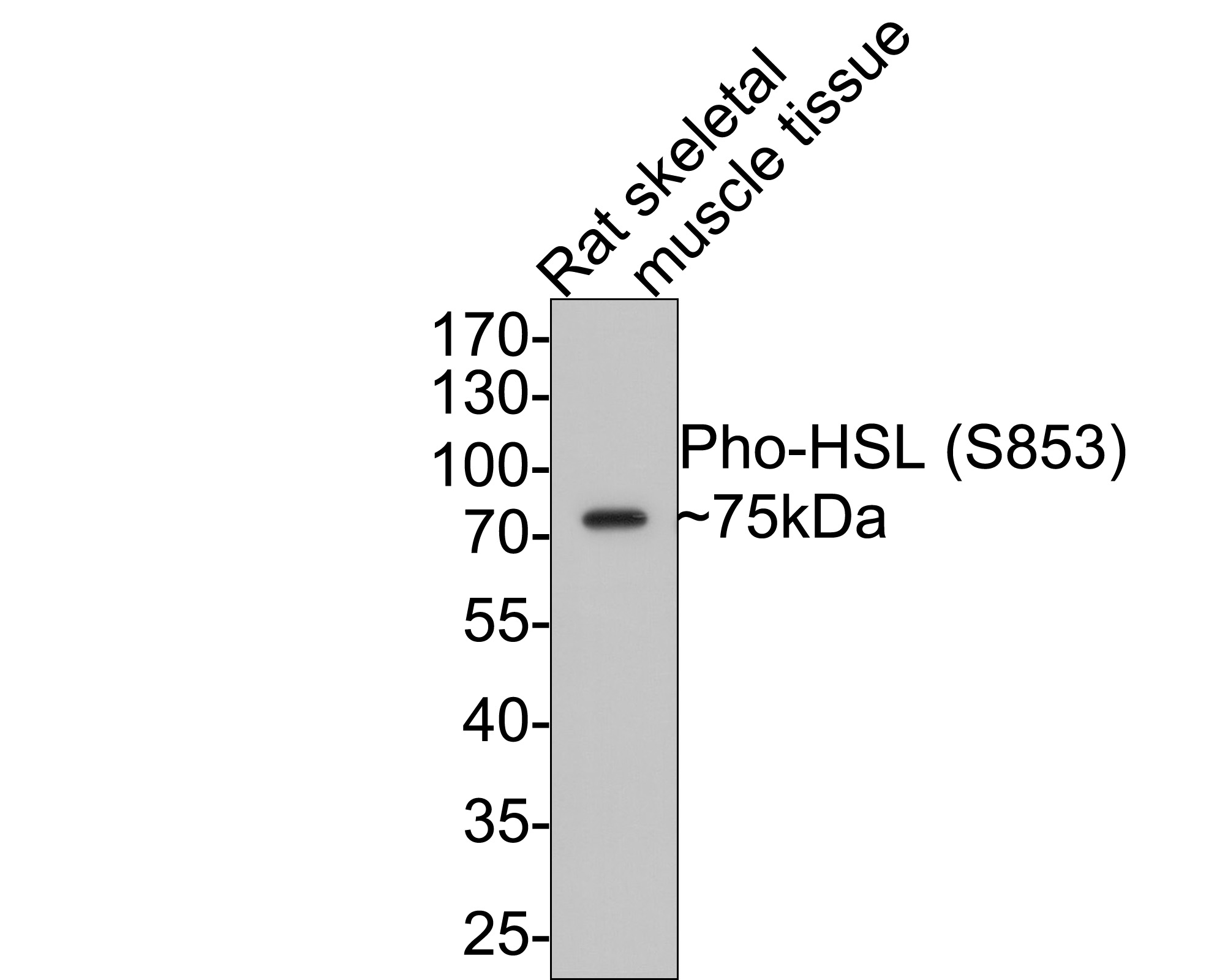 Western blot analysis of Phospho-Hormone sensitive lipase (S853) on rat skeletal muscle tissue lysates with Rabbit anti-Phospho-Hormone sensitive lipase (S853) antibody (ET1611-19) at 1/2,000 dilution.<br />
<br />
Lysates/proteins at 10 µg/Lane.<br />
<br />
Predicted band size: 117 kDa<br />
Observed band size: 75 kDa<br />
<br />
Exposure time: 1 minute;<br />
<br />
10% SDS-PAGE gel.<br />
<br />
Proteins were transferred to a PVDF membrane and blocked with 5% NFDM/TBST for 1 hour at room temperature. The primary antibody (ET1611-19) at 1/2,000 dilution was used in 5% NFDM/TBST at room temperature for 2 hours. Goat Anti-Rabbit IgG - HRP Secondary Antibody (HA1001) at 1:300,000 dilution was used for 1 hour at room temperature.