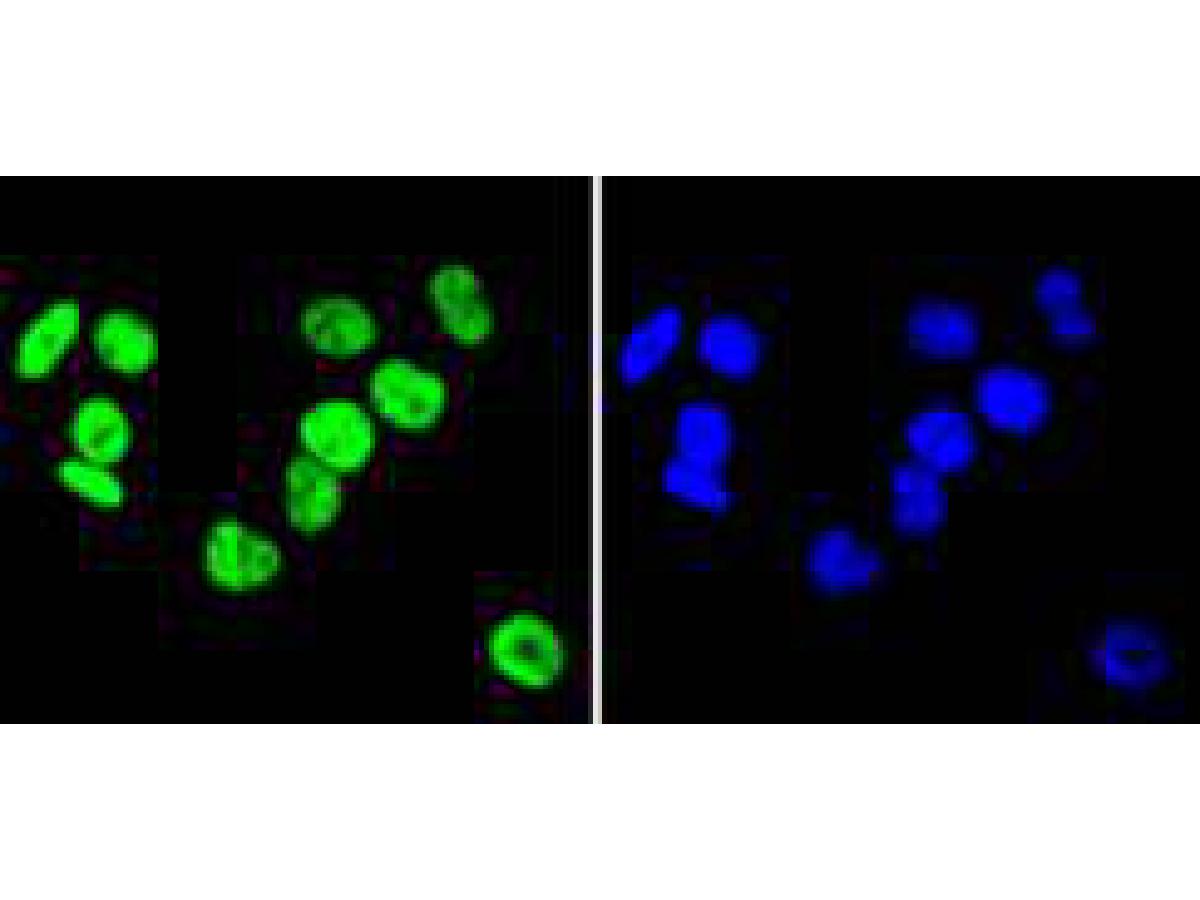 ICC staining hnRNP C1+C2 in MCF-7 cells (green). The nuclear counter stain is DAPI (blue). Cells were fixed in paraformaldehyde, permeabilised with 0.25% Triton X100/PBS.
