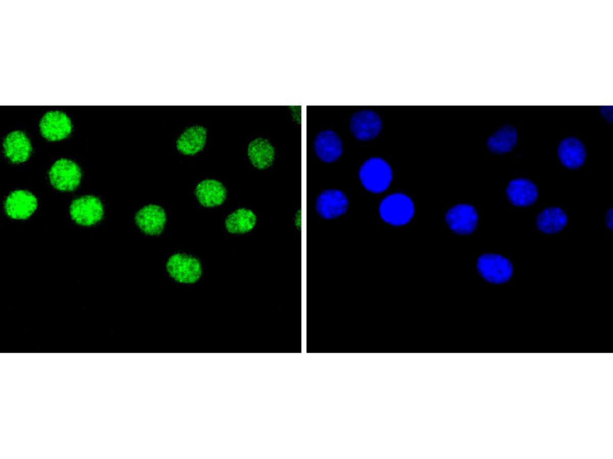 ICC staining hnRNP C1+C2 in B16F1 cells (green). The nuclear counter stain is DAPI (blue). Cells were fixed in paraformaldehyde, permeabilised with 0.25% Triton X100/PBS.