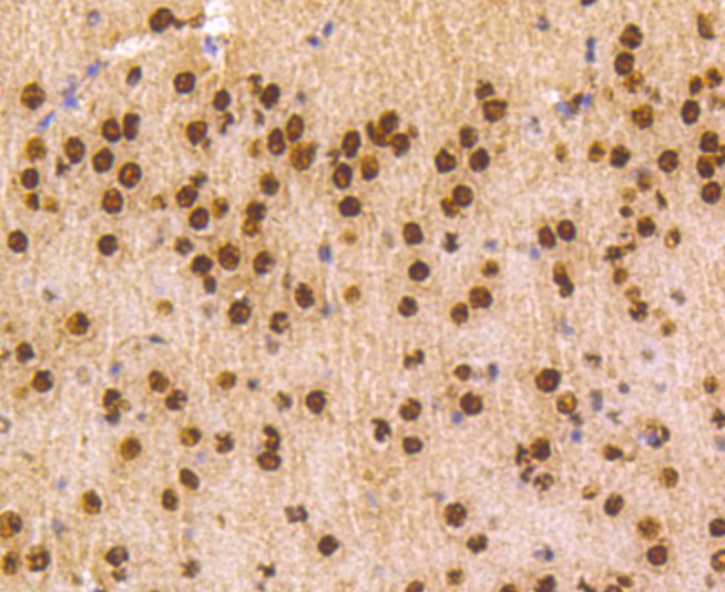 Immunohistochemical analysis of paraffin-embedded mouse brain tissue using anti-hnRNP C1+C2 antibody. Counter stained with hematoxylin.