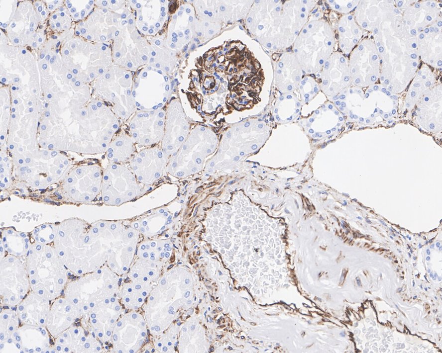 Immunohistochemical analysis of paraffin-embedded human kidney tissue using anti-Nestin antibody. The section was pre-treated using heat mediated antigen retrieval with Tris-EDTA buffer (pH 8.0-8.4) for 20 minutes.The tissues were blocked in 5% BSA for 30 minutes at room temperature, washed with ddH2O and PBS, and then probed with the primary antibody (ET1611-21, 1/50) for 30 minutes at room temperature. The detection was performed using an HRP conjugated compact polymer system. DAB was used as the chromogen. Tissues were counterstained with hematoxylin and mounted with DPX.