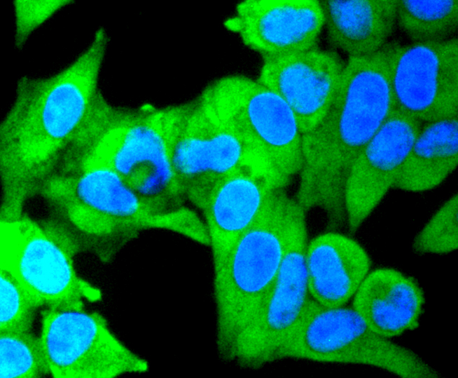 ICC staining of IKK alpha + IKK beta in Hela cells (green). Formalin fixed cells were permeabilized with 0.1% Triton X-100 in TBS for 10 minutes at room temperature and blocked with 1% Blocker BSA for 15 minutes at room temperature. Cells were probed with the primary antibody (ET1611-23, 1/50) for 1 hour at room temperature, washed with PBS. Alexa Fluor®488 Goat anti-Rabbit IgG was used as the secondary antibody at 1/1,000 dilution. The nuclear counter stain is DAPI (blue).