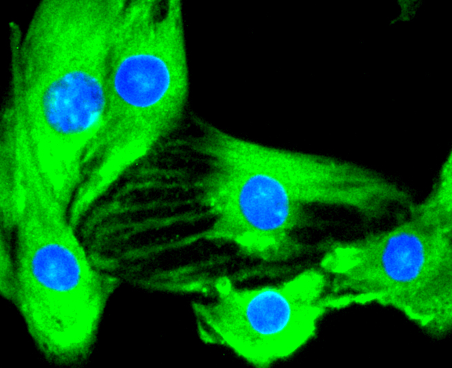 ICC staining of IKK alpha + IKK beta in C2C12 cells (green). Formalin fixed cells were permeabilized with 0.1% Triton X-100 in TBS for 10 minutes at room temperature and blocked with 1% Blocker BSA for 15 minutes at room temperature. Cells were probed with the primary antibody (ET1611-23, 1/50) for 1 hour at room temperature, washed with PBS. Alexa Fluor®488 Goat anti-Rabbit IgG was used as the secondary antibody at 1/1,000 dilution. The nuclear counter stain is DAPI (blue).
