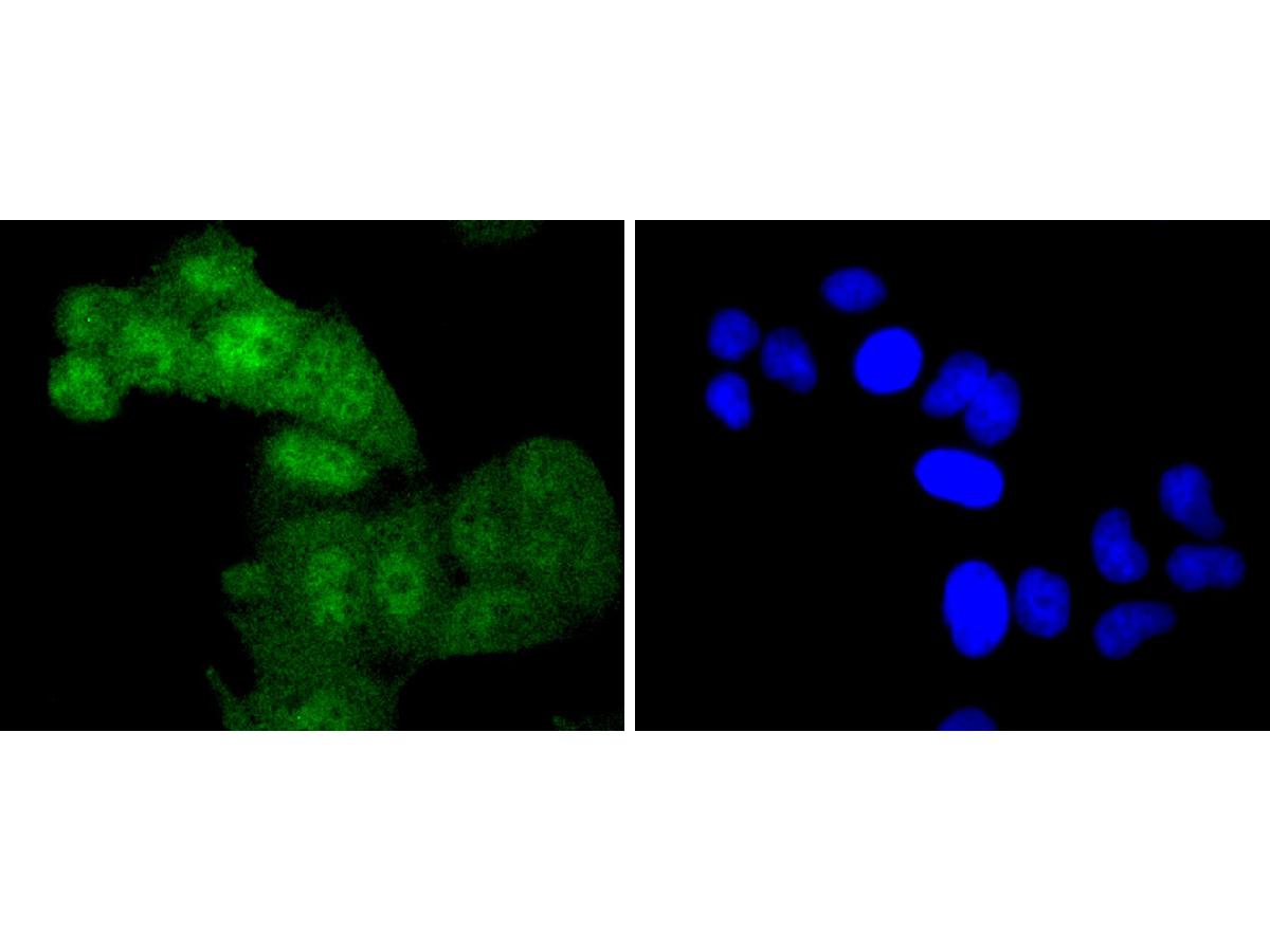 ICC staining of Phospho-c-Myc(T58) in SKOV-3 cells (green). Formalin fixed cells were permeabilized with 0.1% Triton X-100 in TBS for 10 minutes at room temperature and blocked with 1% Blocker BSA for 15 minutes at room temperature. Cells were probed with the primary antibody (ET1611-24, 1/50) for 1 hour at room temperature, washed with PBS. Alexa Fluor®488 Goat anti-Rabbit IgG was used as the secondary antibody at 1/1,000 dilution. The nuclear counter stain is DAPI (blue).