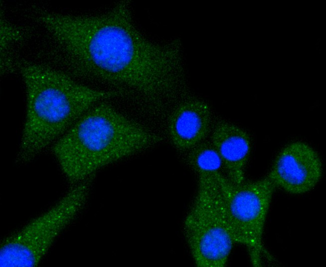 ICC staining of Phospholipase C gamma 1 in SHG-44 cells (green). Formalin fixed cells were permeabilized with 0.1% Triton X-100 in TBS for 10 minutes at room temperature and blocked with 10% negative goat serum for 15 minutes at room temperature. Cells were probed with the primary antibody (ET1611-25, 1/50) for 1 hour at room temperature, washed with PBS. Alexa Fluor®488 conjugate-Goat anti-Rabbit IgG was used as the secondary antibody at 1/1,000 dilution. The nuclear counter stain is DAPI (blue).