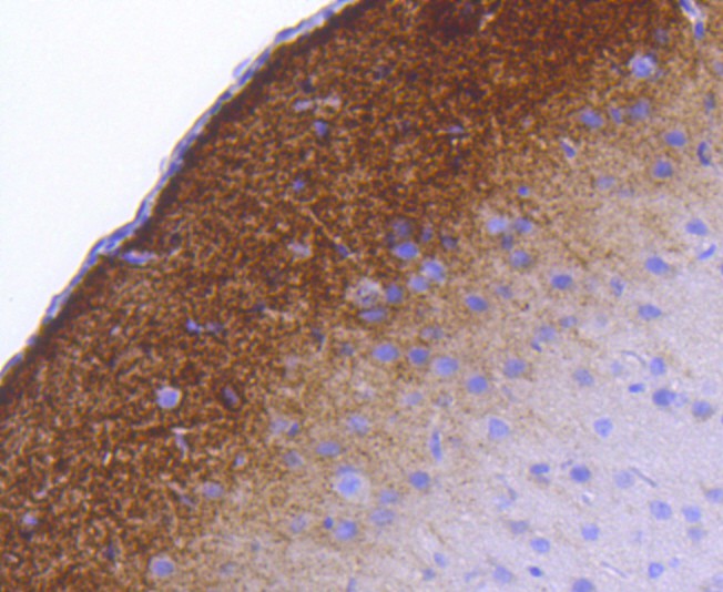 Immunohistochemical analysis of paraffin-embedded rat brain tissue using anti-Phospho-Synapsin Ⅰ (S9) antibody. The section was pre-treated using heat mediated antigen retrieval with Tris-EDTA buffer (pH 8.0-8.4) for 20 minutes.The tissues were blocked in 5% BSA for 30 minutes at room temperature, washed with ddH2O and PBS, and then probed with the primary antibody (ET1611-26, 1/50) for 30 minutes at room temperature. The detection was performed using an HRP conjugated compact polymer system. DAB was used as the chromogen. Tissues were counterstained with hematoxylin and mounted with DPX.