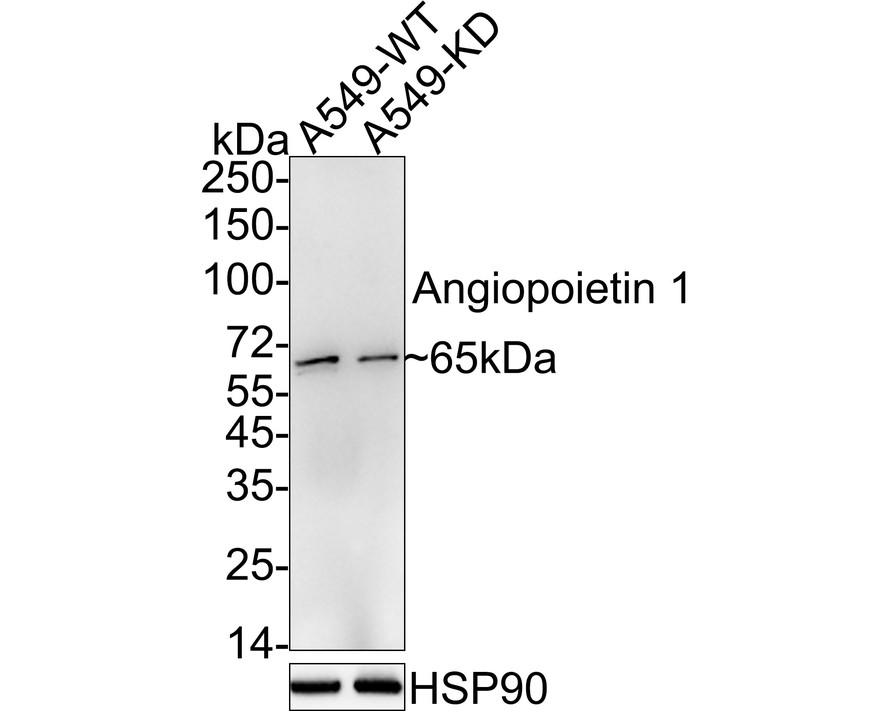 Western blot analysis of Angiopoietin 1 on K562 cell lysates. Proteins were transferred to a PVDF membrane and blocked with 5% BSA in PBS for 1 hour at room temperature. The primary antibody (ET1611-28, 1/500) was used in 5% BSA at room temperature for 2 hours. Goat Anti-Rabbit IgG - HRP Secondary Antibody (HA1001) at 1:5,000 dilution was used for 1 hour at room temperature.