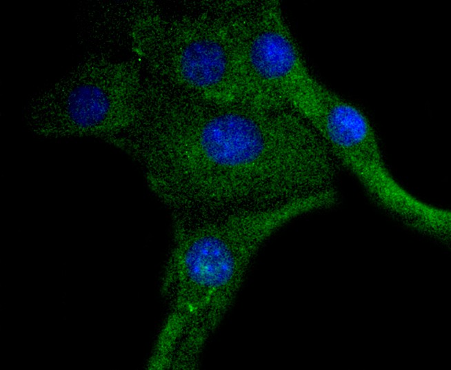 ICC staining PDGF Receptor beta(phospho Y740) in Hela cells (green). The nuclear counter stain is DAPI (blue). Cells were fixed in paraformaldehyde, permeabilised with 0.25% Triton X100/PBS.