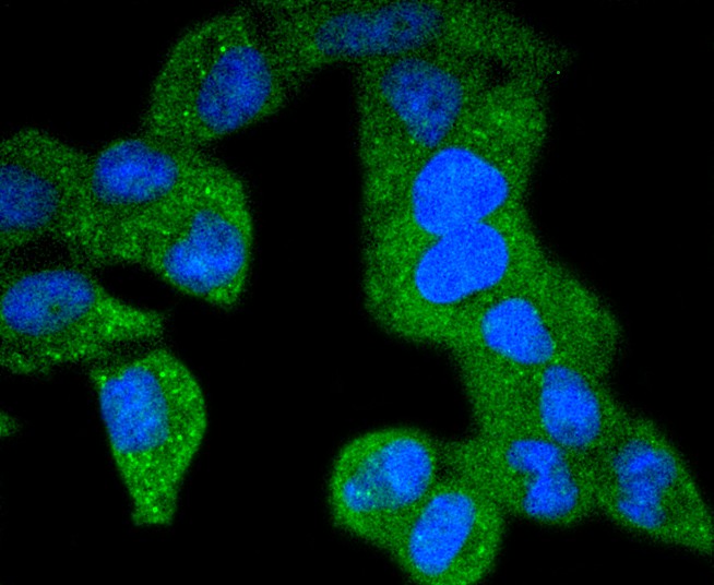 ICC staining PDGF Receptor beta(phospho Y740) in L6 cells (green). The nuclear counter stain is DAPI (blue). Cells were fixed in paraformaldehyde, permeabilised with 0.25% Triton X100/PBS.