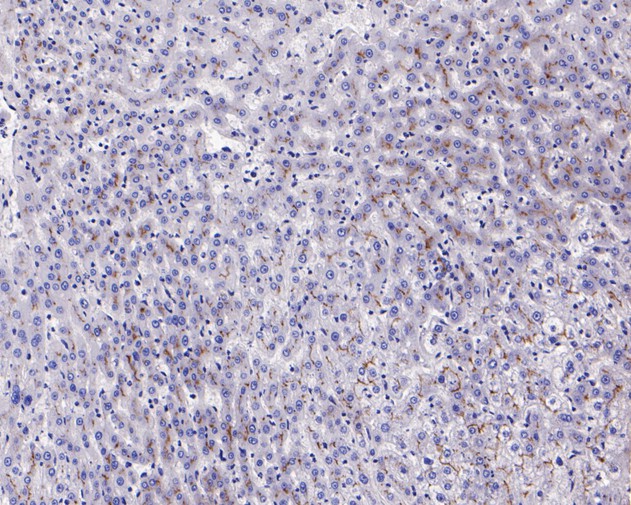 Immunohistochemical analysis of paraffin-embedded human kidney tissue using anti-P Glycoprotein antibody. The section was pre-treated using heat mediated antigen retrieval with Tris-EDTA buffer (pH 8.0-8.4) for 20 minutes.The tissues were blocked in 5% BSA for 30 minutes at room temperature, washed with ddH2O and PBS, and then probed with the primary antibody (ET1611-30, 1/50) for 30 minutes at room temperature. The detection was performed using an HRP conjugated compact polymer system. DAB was used as the chromogen. Tissues were counterstained with hematoxylin and mounted with DPX.