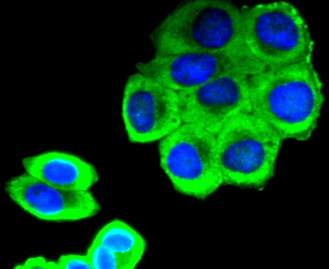 ICC staining Phospho-SIRT1 (S47) in SW480 cells (green). The nuclear counter stain is DAPI (blue). Cells were fixed in paraformaldehyde, permeabilised with 0.25% Triton X100/PBS.