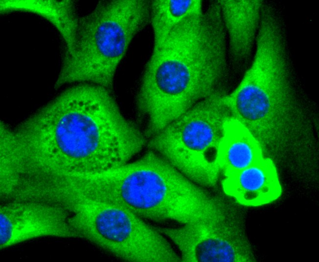ICC staining of RAD18 in NIH/3T3 cells (green). Formalin fixed cells were permeabilized with 0.1% Triton X-100 in TBS for 10 minutes at room temperature and blocked with 10% negative goat serum for 15 minutes at room temperature. Cells were probed with the primary antibody (ET1611-32, 1/50) for 1 hour at room temperature, washed with PBS. Alexa Fluor®488 conjugate-Goat anti-Rabbit IgG was used as the secondary antibody at 1/1,000 dilution. The nuclear counter stain is DAPI (blue).
