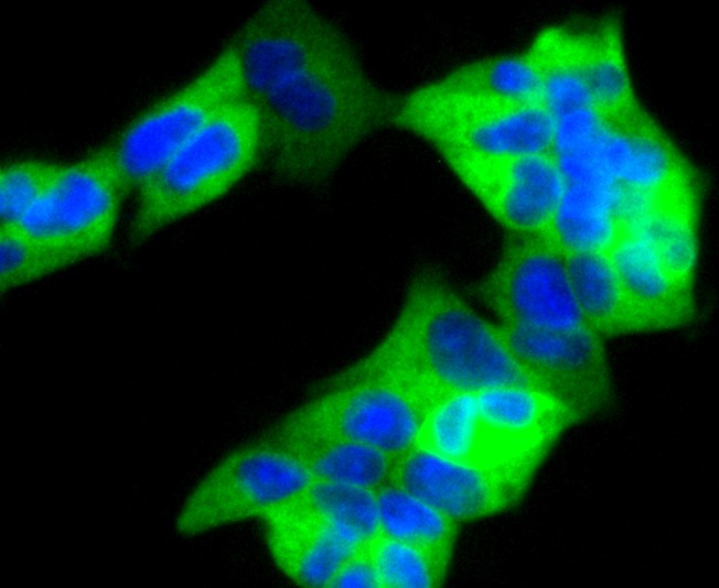 ICC staining of RAD18 in 293 cells (green). Formalin fixed cells were permeabilized with 0.1% Triton X-100 in TBS for 10 minutes at room temperature and blocked with 10% negative goat serum for 15 minutes at room temperature. Cells were probed with the primary antibody (ET1611-32, 1/50) for 1 hour at room temperature, washed with PBS. Alexa Fluor®488 conjugate-Goat anti-Rabbit IgG was used as the secondary antibody at 1/1,000 dilution. The nuclear counter stain is DAPI (blue).