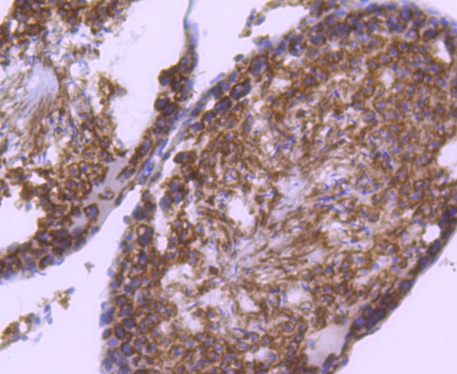 Immunohistochemical analysis of paraffin-embedded rat testis tissue using anti-RAD18 antibody. The section was pre-treated using heat mediated antigen retrieval with Tris-EDTA buffer (pH 9.0) for 20 minutes.The tissues were blocked in 1% BSA for 30 minutes at room temperature, washed with ddH2O and PBS, and then probed with the primary antibody (ET1611-32, 1/50) for 30 minutes at room temperature. The detection was performed using an HRP conjugated compact polymer system. DAB was used as the chromogen. Tissues were counterstained with hematoxylin and mounted with DPX.