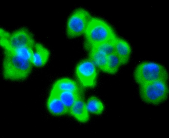 ICC staining of MMP11 in SW480 cells (green). Formalin fixed cells were permeabilized with 0.1% Triton X-100 in TBS for 10 minutes at room temperature and blocked with 1% Blocker BSA for 15 minutes at room temperature. Cells were probed with the primary antibody (ET1611-33, 1/50) for 1 hour at room temperature, washed with PBS. Alexa Fluor®488 Goat anti-Rabbit IgG was used as the secondary antibody at 1/1,000 dilution. The nuclear counter stain is DAPI (blue).