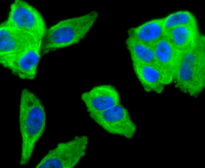 ICC staining of MMP11 in MCF-7 cells (green). Formalin fixed cells were permeabilized with 0.1% Triton X-100 in TBS for 10 minutes at room temperature and blocked with 1% Blocker BSA for 15 minutes at room temperature. Cells were probed with the primary antibody (ET1611-33, 1/50) for 1 hour at room temperature, washed with PBS. Alexa Fluor®488 Goat anti-Rabbit IgG was used as the secondary antibody at 1/1,000 dilution. The nuclear counter stain is DAPI (blue).