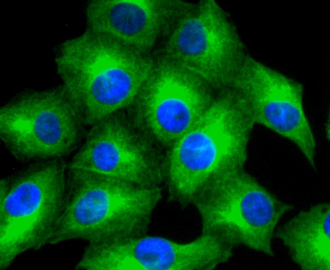 ICC staining of MMP11 in A549 cells (green). Formalin fixed cells were permeabilized with 0.1% Triton X-100 in TBS for 10 minutes at room temperature and blocked with 1% Blocker BSA for 15 minutes at room temperature. Cells were probed with the primary antibody (ET1611-33, 1/50) for 1 hour at room temperature, washed with PBS. Alexa Fluor®488 Goat anti-Rabbit IgG was used as the secondary antibody at 1/1,000 dilution. The nuclear counter stain is DAPI (blue).