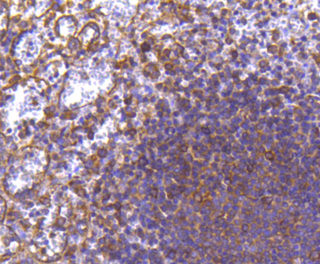 Immunohistochemical analysis of paraffin-embedded human spleen tissue using anti-MMP11 antibody. The section was pre-treated using heat mediated antigen retrieval with Tris-EDTA buffer (pH 8.0-8.4) for 20 minutes.The tissues were blocked in 5% BSA for 30 minutes at room temperature, washed with ddH2O and PBS, and then probed with the primary antibody (ET1611-33, 1/50) for 30 minutes at room temperature. The detection was performed using an HRP conjugated compact polymer system. DAB was used as the chromogen. Tissues were counterstained with hematoxylin and mounted with DPX.