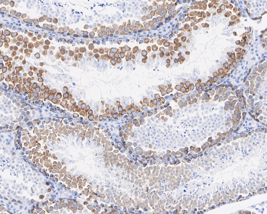 ICC staining of TACC3 in PC-3M cells (green). Formalin fixed cells were permeabilized with 0.1% Triton X-100 in TBS for 10 minutes at room temperature and blocked with 1% Blocker BSA for 15 minutes at room temperature. Cells were probed with the primary antibody (ET1611-34, 1/50) for 1 hour at room temperature, washed with PBS. Alexa Fluor®488 Goat anti-Rabbit IgG was used as the secondary antibody at 1/1,000 dilution. The nuclear counter stain is DAPI (blue).