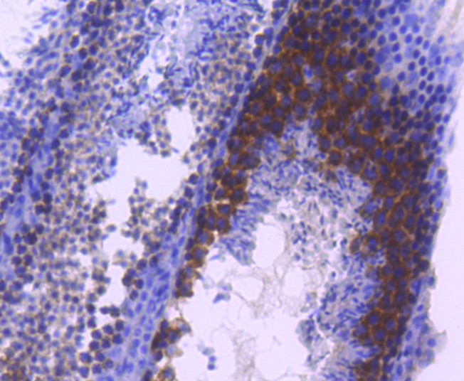 Immunohistochemical analysis of paraffin-embedded mouse testis tissue using anti-TACC3 antibody. The section was pre-treated using heat mediated antigen retrieval with Tris-EDTA buffer (pH 8.0-8.4) for 20 minutes.The tissues were blocked in 5% BSA for 30 minutes at room temperature, washed with ddH2O and PBS, and then probed with the primary antibody (ET1611-34, 1/50) for 30 minutes at room temperature. The detection was performed using an HRP conjugated compact polymer system. DAB was used as the chromogen. Tissues were counterstained with hematoxylin and mounted with DPX.