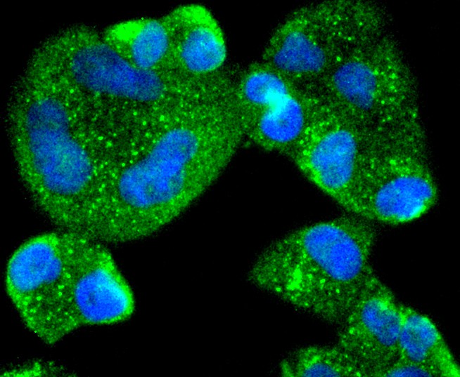 ICC staining of AGR2 in Hela cells (green). Formalin fixed cells were permeabilized with 0.1% Triton X-100 in TBS for 10 minutes at room temperature and blocked with 1% Blocker BSA for 15 minutes at room temperature. Cells were probed with the primary antibody (ET1611-36, 1/50) for 1 hour at room temperature, washed with PBS. Alexa Fluor®488 Goat anti-Rabbit IgG was used as the secondary antibody at 1/1,000 dilution. The nuclear counter stain is DAPI (blue).