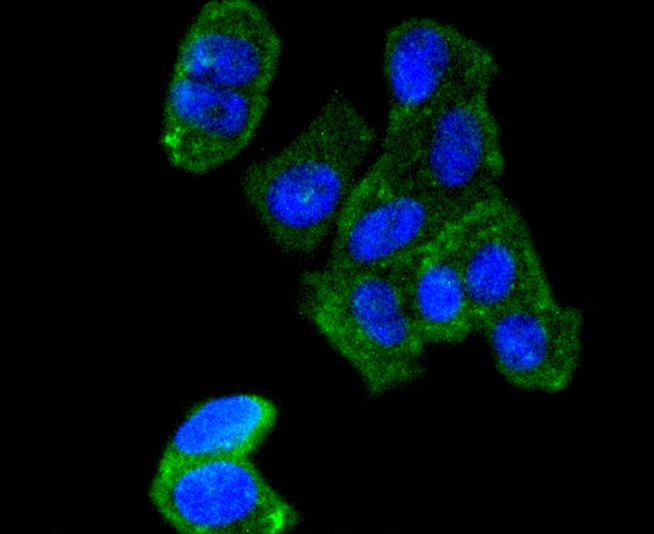 ICC staining of AGR2 in NIH/3T3 cells (green). Formalin fixed cells were permeabilized with 0.1% Triton X-100 in TBS for 10 minutes at room temperature and blocked with 1% Blocker BSA for 15 minutes at room temperature. Cells were probed with the primary antibody (ET1611-36, 1/50) for 1 hour at room temperature, washed with PBS. Alexa Fluor®488 Goat anti-Rabbit IgG was used as the secondary antibody at 1/1,000 dilution. The nuclear counter stain is DAPI (blue).