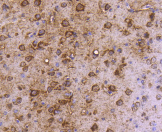 Immunohistochemical analysis of paraffin-embedded mouse brain tissue using anti-MAP1LC3A antibody. The section was pre-treated using heat mediated antigen retrieval with Tris-EDTA buffer (pH 8.0-8.4) for 20 minutes.The tissues were blocked in 5% BSA for 30 minutes at room temperature, washed with ddH2O and PBS, and then probed with the primary antibody (ET1611-37, 1/50) for 30 minutes at room temperature. The detection was performed using an HRP conjugated compact polymer system. DAB was used as the chromogen. Tissues were counterstained with hematoxylin and mounted with DPX.