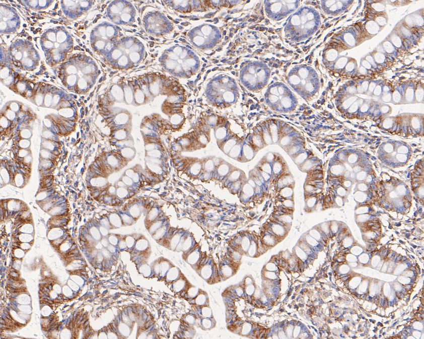 Immunohistochemical analysis of paraffin-embedded human small intestine tissue using anti-NSD3 antibody. The section was pre-treated using heat mediated antigen retrieval with Tris-EDTA buffer (pH 8.0-8.4) for 20 minutes.The tissues were blocked in 5% BSA for 30 minutes at room temperature, washed with ddH2O and PBS, and then probed with the primary antibody (ET1611-39, 1/200) for 30 minutes at room temperature. The detection was performed using an HRP conjugated compact polymer system. DAB was used as the chromogen. Tissues were counterstained with hematoxylin and mounted with DPX.