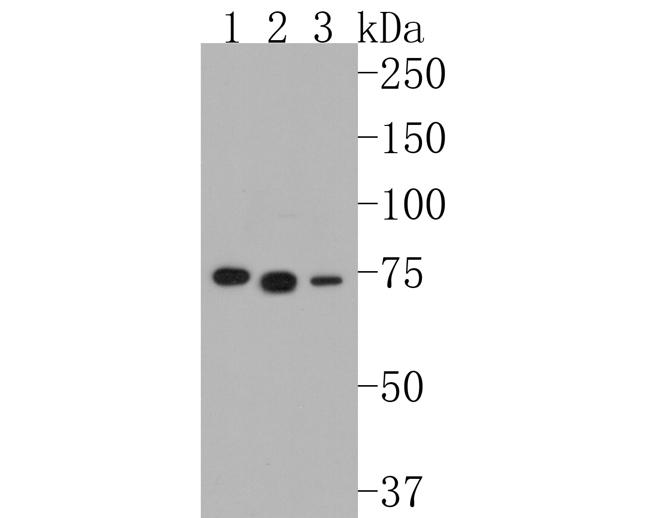 Western blot analysis of BTK on different lysates. Proteins were transferred to a PVDF membrane and blocked with 5% BSA in PBS for 1 hour at room temperature. The primary antibody (ET1611-4, 1/500) was used in 5% BSA at room temperature for 2 hours. Goat Anti-Rabbit IgG - HRP Secondary Antibody (HA1001) at 1:5,000 dilution was used for 1 hour at room temperature.<br />
Positive control: <br />
Lane 1: Daudi cell lysate<br />
Lane 2: Raji cell lysate<br />
Lane 3: U937 cell lysate