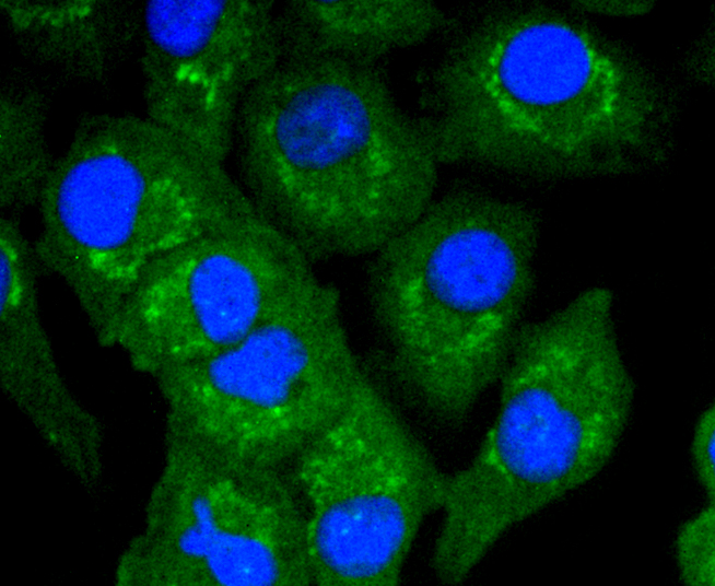 ICC staining of TNFAIP3 in A549 cells (green). Formalin fixed cells were permeabilized with 0.1% Triton X-100 in TBS for 10 minutes at room temperature and blocked with 1% Blocker BSA for 15 minutes at room temperature. Cells were probed with the primary antibody (ET1611-40, 1/50) for 1 hour at room temperature, washed with PBS. Alexa Fluor®488 Goat anti-Rabbit IgG was used as the secondary antibody at 1/1,000 dilution. The nuclear counter stain is DAPI (blue).