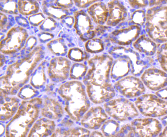 Immunohistochemical analysis of paraffin-embedded human kidney tissue using anti-TNFAIP3 antibody. The section was pre-treated using heat mediated antigen retrieval with Tris-EDTA buffer (pH 8.0-8.4) for 20 minutes.The tissues were blocked in 5% BSA for 30 minutes at room temperature, washed with ddH2O and PBS, and then probed with the primary antibody (ET1611-40, 1/50) for 30 minutes at room temperature. The detection was performed using an HRP conjugated compact polymer system. DAB was used as the chromogen. Tissues were counterstained with hematoxylin and mounted with DPX.