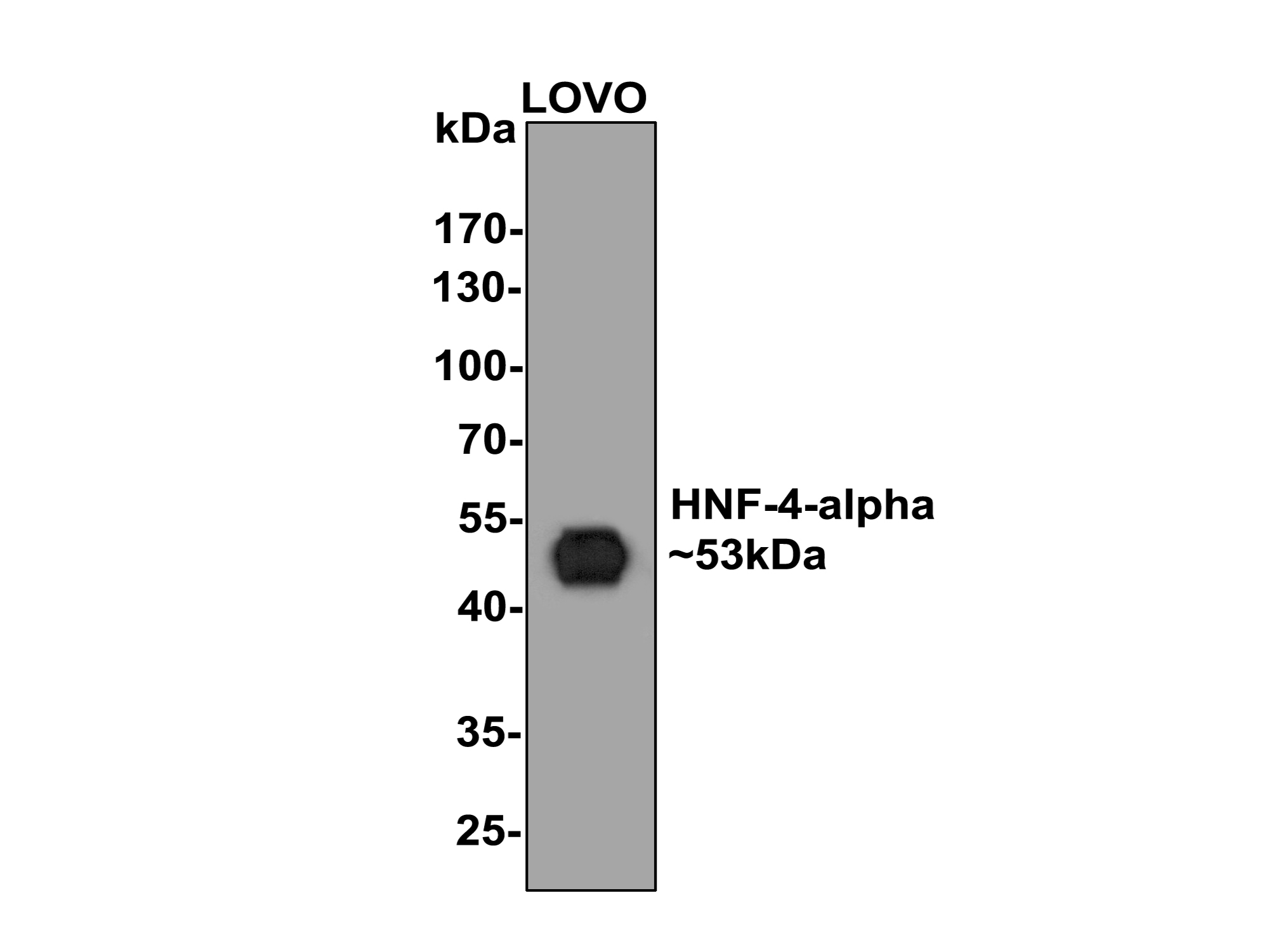 Western blot analysis of HNF-4-alpha on LOVO cell lysates with Rabbit anti-HNF-4-alpha antibody (ET1611-43) at 1/500 dilution.<br />
<br />
Lysates/proteins at 10 µg/Lane.<br />
<br />
Predicted band size: 53 kDa<br />
Observed band size: 53 kDa<br />
<br />
Exposure time: 2 minutes;<br />
<br />
10% SDS-PAGE gel.<br />
<br />
Proteins were transferred to a PVDF membrane and blocked with 5% NFDM/TBST for 1 hour at room temperature. The primary antibody (ET1611-43) at 1/500 dilution was used in 5% NFDM/TBST at room temperature for 2 hours. Goat Anti-Rabbit IgG - HRP Secondary Antibody (HA1001) at 1:200,000 dilution was used for 1 hour at room temperature.
