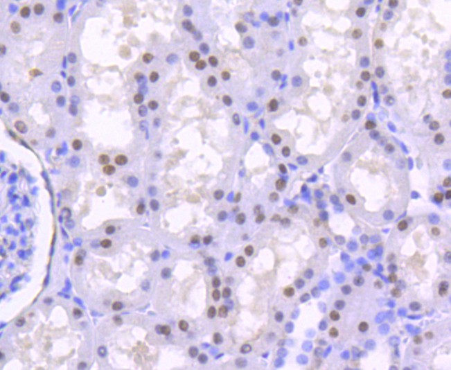 Immunohistochemical analysis of paraffin-embedded human kidney tissue using anti-HNF-4-alpha antibody. The section was pre-treated using heat mediated antigen retrieval with Tris-EDTA buffer (pH 8.0-8.4) for 20 minutes.The tissues were blocked in 5% BSA for 30 minutes at room temperature, washed with ddH2O and PBS, and then probed with the primary antibody (ET1611-43, 1/50) for 30 minutes at room temperature. The detection was performed using an HRP conjugated compact polymer system. DAB was used as the chromogen. Tissues were counterstained with hematoxylin and mounted with DPX.