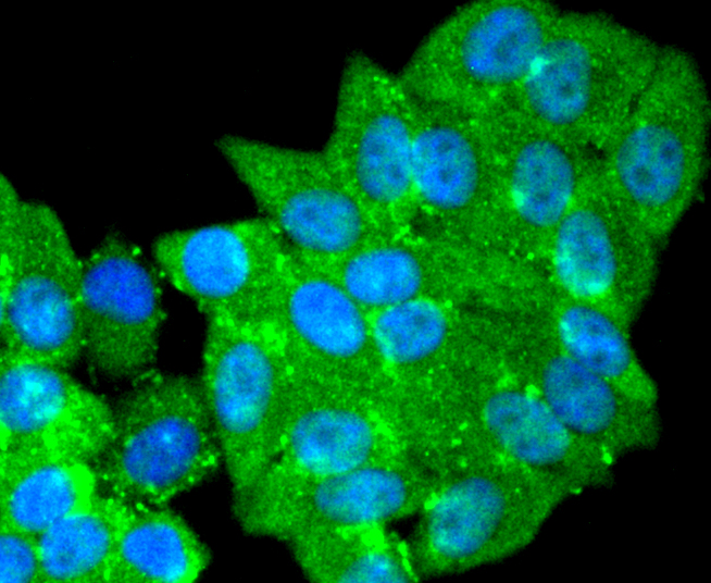 ICC staining of PARK7/DJ1 in HepG2 cells (green). Formalin fixed cells were permeabilized with 0.1% Triton X-100 in TBS for 10 minutes at room temperature and blocked with 1% Blocker BSA for 15 minutes at room temperature. Cells were probed with the primary antibody (ET1611-45, 1/50) for 1 hour at room temperature, washed with PBS. Alexa Fluor®488 Goat anti-Rabbit IgG was used as the secondary antibody at 1/1,000 dilution. The nuclear counter stain is DAPI (blue).