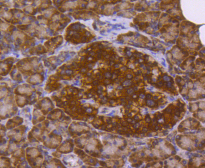 Immunohistochemical analysis of paraffin-embedded human pancreas tissue using anti-PARK7/DJ1 antibody. The section was pre-treated using heat mediated antigen retrieval with Tris-EDTA buffer (pH 8.0-8.4) for 20 minutes.The tissues were blocked in 5% BSA for 30 minutes at room temperature, washed with ddH2O and PBS, and then probed with the primary antibody (ET1611-45, 1/50) for 30 minutes at room temperature. The detection was performed using an HRP conjugated compact polymer system. DAB was used as the chromogen. Tissues were counterstained with hematoxylin and mounted with DPX.