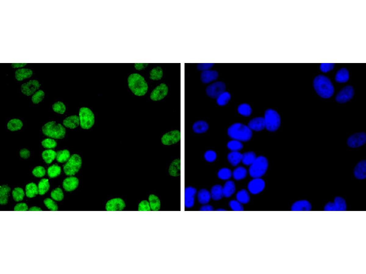 ICC staining Histone H2B(acetyl K20)  (1/200) in MCF-7 cells (green). The nuclear counter stain is DAPI (blue). Cells were fixed in paraformaldehyde, permeabilised with 0.25% Triton X100/PBS.