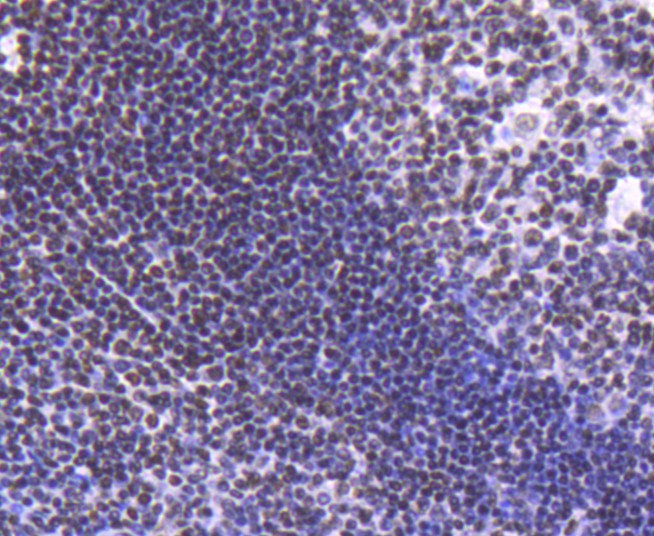 Immunohistochemical analysis of paraffin-embedded human tonsil tissue using anti-Histone H2B(acetyl K20) antibody at 1/50 dilution. Counter stained with hematoxylin.