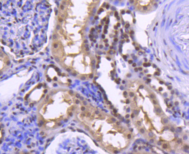 Immunohistochemical analysis of paraffin-embedded human kidney tissue using anti-Histone H2B(acetyl K20) antibody at 1/50 dilution. Counter stained with hematoxylin.