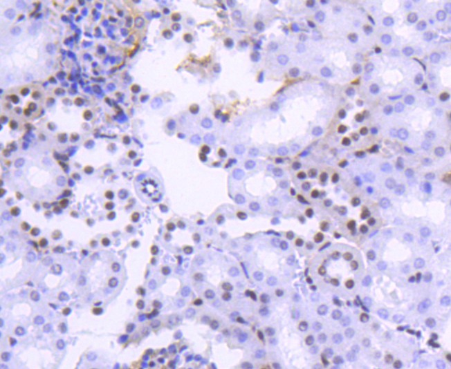 Immunohistochemical analysis of paraffin-embedded mouse kidney tissue using anti-Histone H2B(acetyl K20) antibody at 1/50 dilution. Counter stained with hematoxylin.
